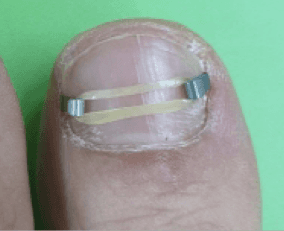 오니코X립 제품 사진